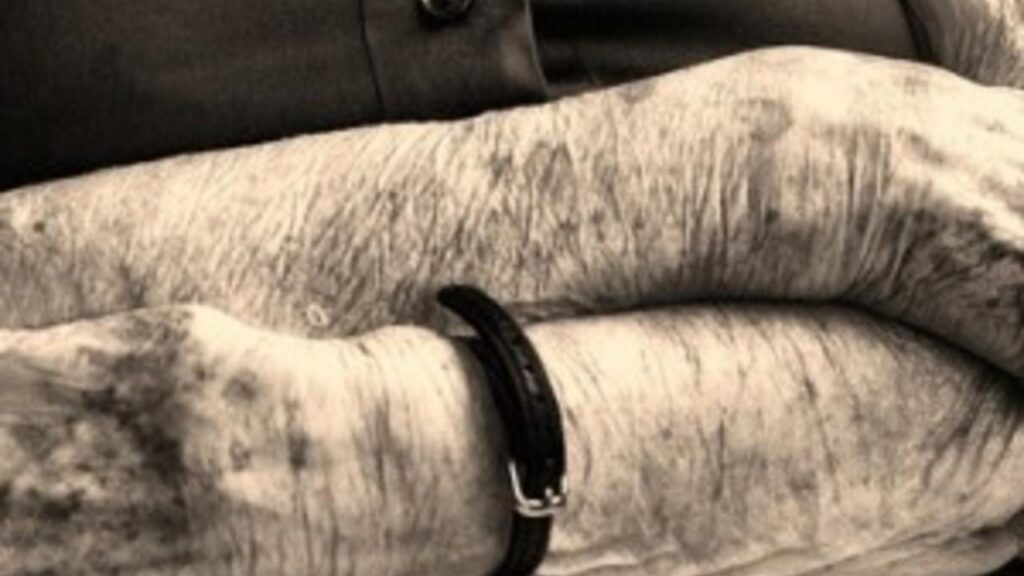 What Happens When My Mother Runs Out of Money?